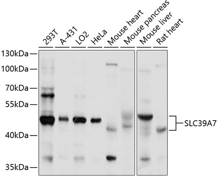 Anti-SLC39A7 Antibody (CAB3343)