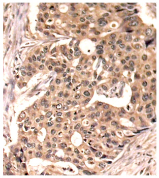 Anti-Phospho-Paxillin-Y118 Antibody (CABP0156)