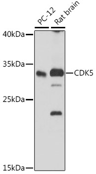 Anti-CDK5 Antibody (CAB5730)