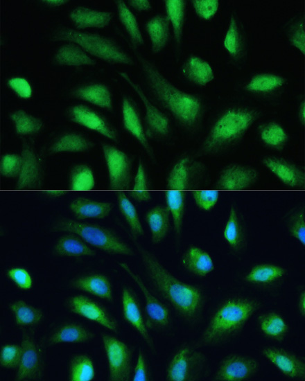 Anti-LGALS3 Antibody [KO Validated] (CAB13506)