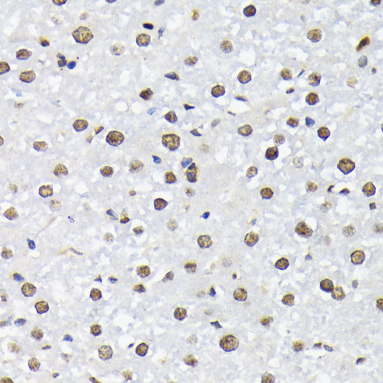 Anti-Phospho-FoxO1-T24/FoxO3a-T32/FoxO4-T28 pAb (CABP0892)