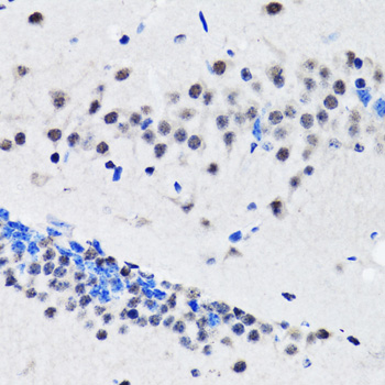 Anti-RUVBL2 Antibody (CAB1905)