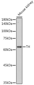 Anti-TH Antibody (CAB12756)