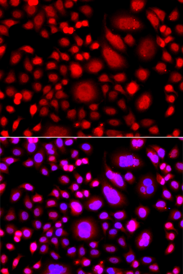 Anti-PRKAG3 Antibody (CAB14132)