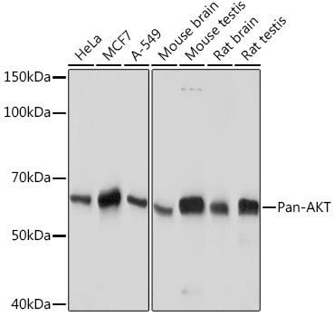 Anti-Pan-AKT Rabbit Monoclonal Antibody (CAB18675)