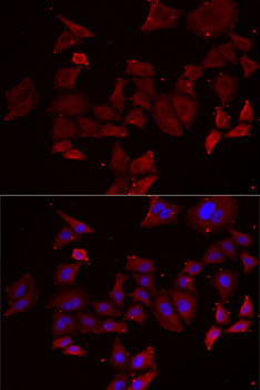 Anti-NPHP1 Antibody (CAB6674)