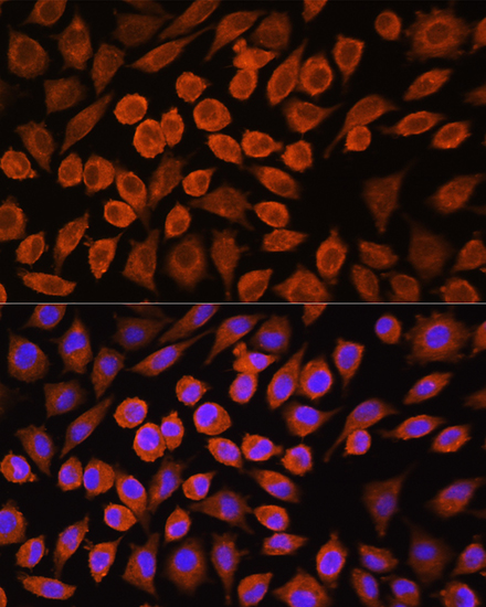 Anti-PDP1 Antibody (CAB14545)