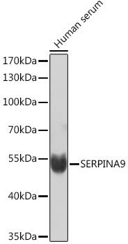 Anti-SERPINA9 Antibody (CAB16182)