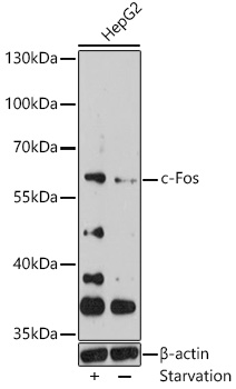 Anti-c-Fos Antibody (CAB0236)