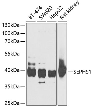 Anti-SEPHS1 Antibody (CAB6454)