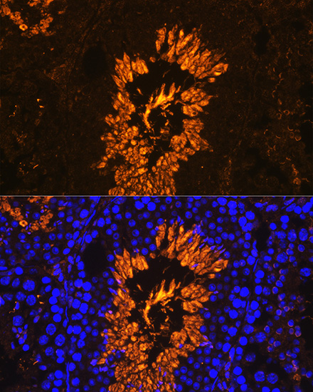 Anti-AKAP4 Antibody (CAB14813)