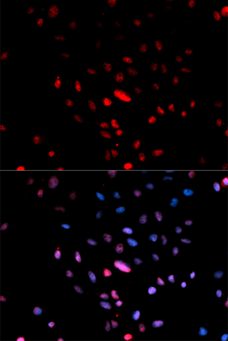 Anti-Phospho-Jun-S73 Antibody (CABP0047)