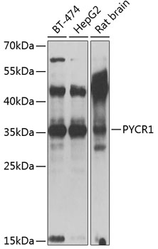 Anti-PYCR1 Antibody (CAB13346)