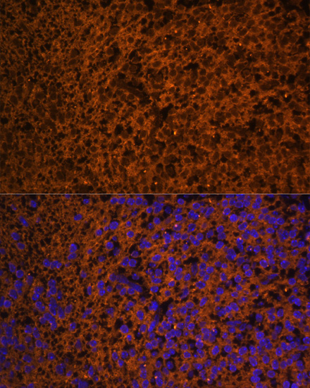 Anti-PTCH1 Antibody (CAB14772)