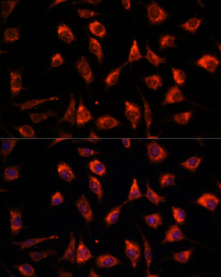 Anti-TPT1 Antibody (CAB13367)