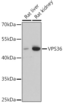 Anti-VPS36 Antibody (CAB15157)