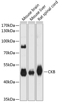 Anti-CKB Antibody (CAB12632)