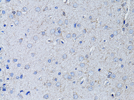 Anti-RYR2 Antibody (CAB0298)