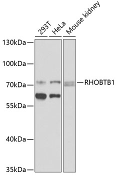 Anti-RHOBTB1 Polyclonal Antibody (CAB9959)