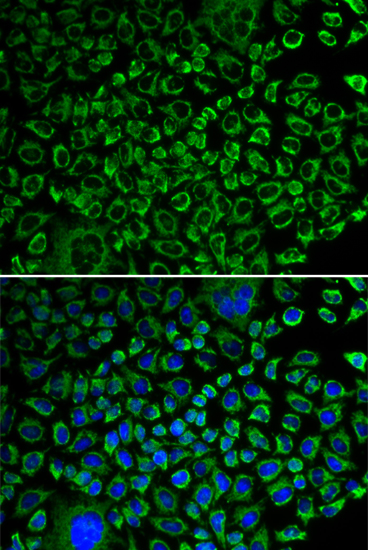 Anti-F10 Antibody (CAB1452)