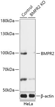 Anti-BMPR2 Antibody [KO Validated] (CAB18079)