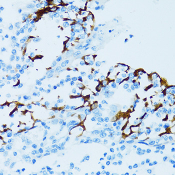 Anti-CTSE Antibody (CAB2678)