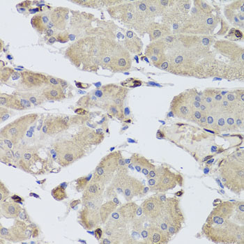 Anti-FABP5 Antibody (CAB0947)