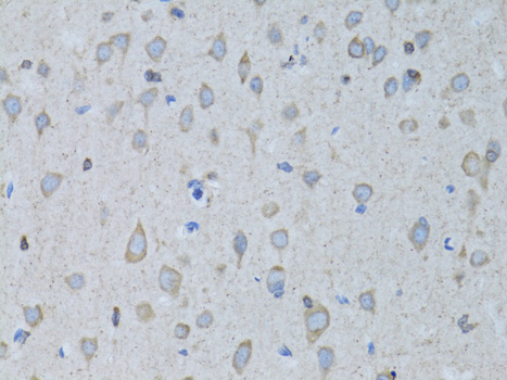 Anti-GABARAP Antibody (CAB5616)