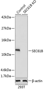 Anti-SEC61B Antibody [KO Validated] (CAB15788)