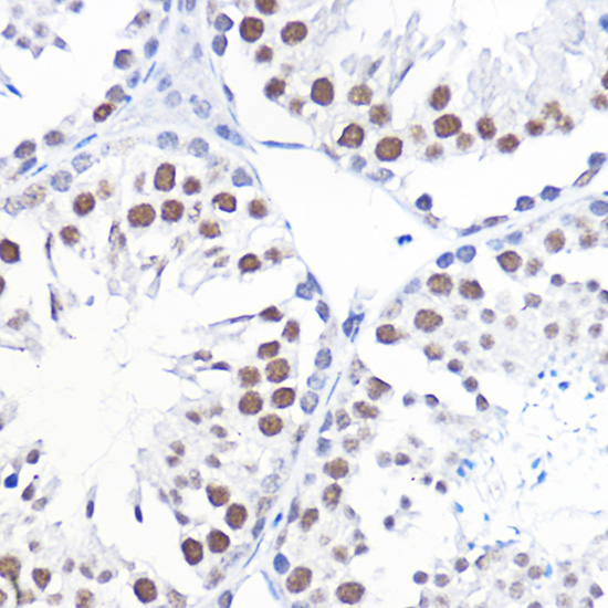 Anti-GTF2B Antibody (CAB1708)