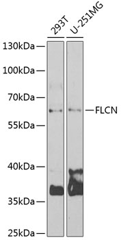 Anti-FLCN Antibody (CAB6493)