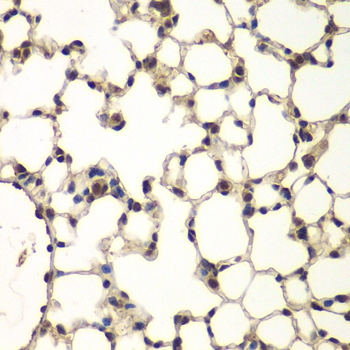 Anti-PHF11 Antibody (CAB13426)