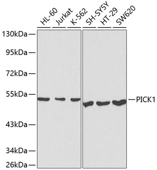 Anti-PICK1 Antibody (CAB1519)
