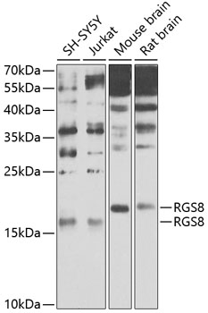 Anti-RGS8 Polyclonal Antibody (CAB9987)