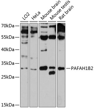 Anti-PAFAH1B2 Antibody (CAB12170)