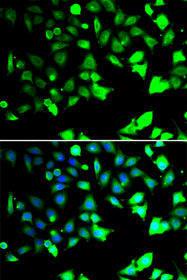 Anti-XIAP Antibody (CAB13277)