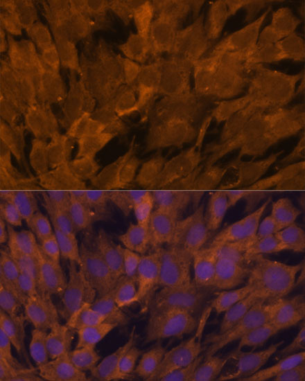 Anti-STAM2 Antibody (CAB7058)