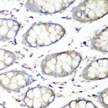 Anti-SH3GLB2 Antibody (CAB7599)