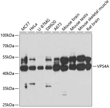 Anti-VPS4A Antibody (CAB7096)