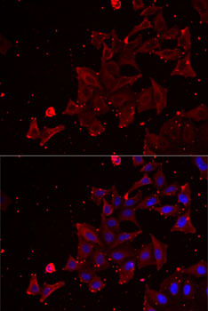 Anti-MSRA Antibody (CAB6389)