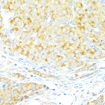 Anti-Bax Antibody [KO Validated] (CAB12009)