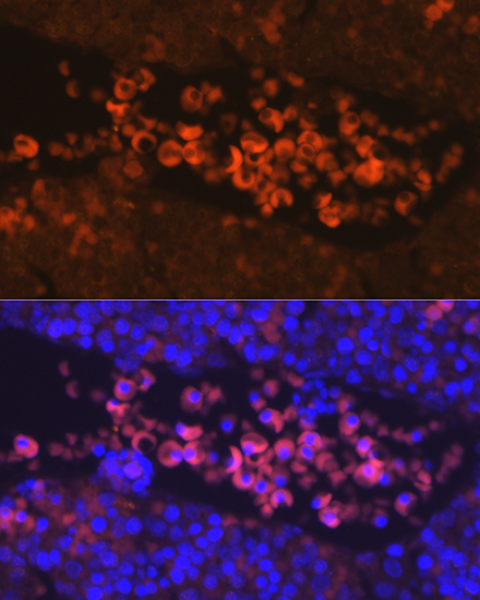 Anti-EPOR Antibody (CAB2917)