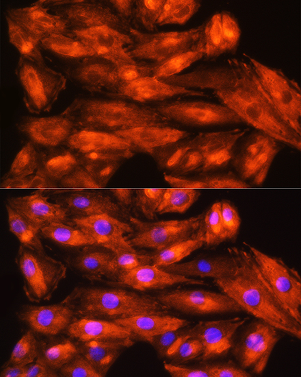 Anti-ZCCHC11 Antibody (CAB5972)