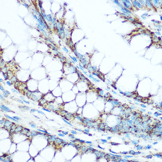 Anti-UQCRC1 Antibody (CAB3339)