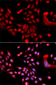 Anti-U2AF1 Antibody (CAB6076)