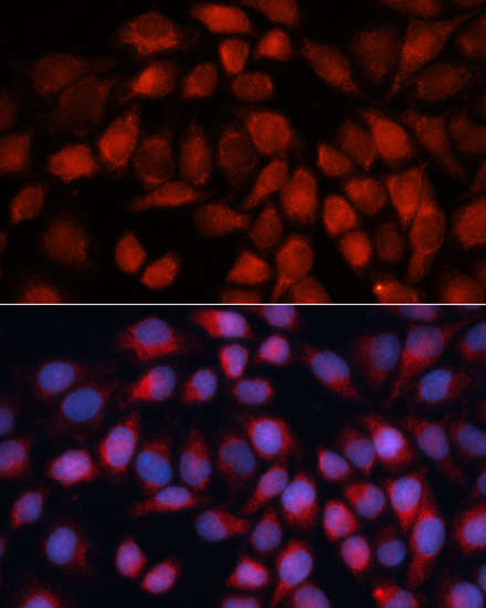 Anti-ACADM Antibody (CAB1873)