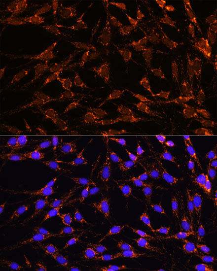 Anti-XK Antibody (CAB15109)