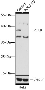 Anti-POLB Antibody [KO Validated] (CAB1681)