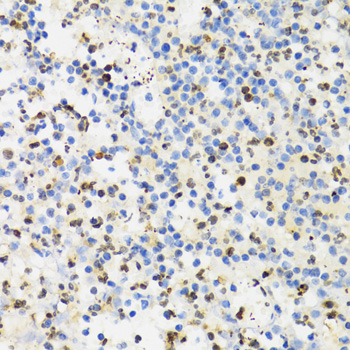 Anti-SUMO4 Antibody (CAB3100)