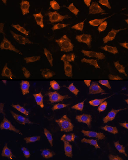 Anti-CYR61 Antibody (CAB1111)